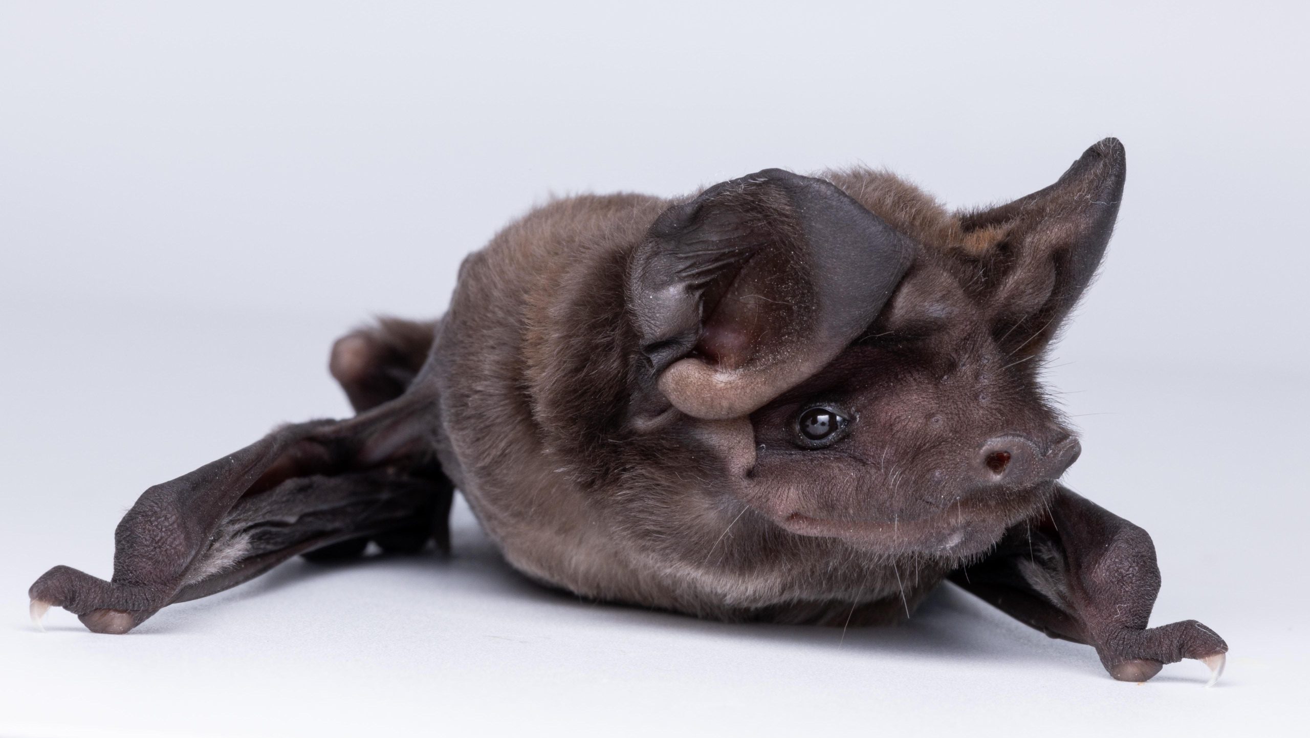 "Quilos Mortais": como está J.T., que pesava 404 kg e tinha linfedema grave