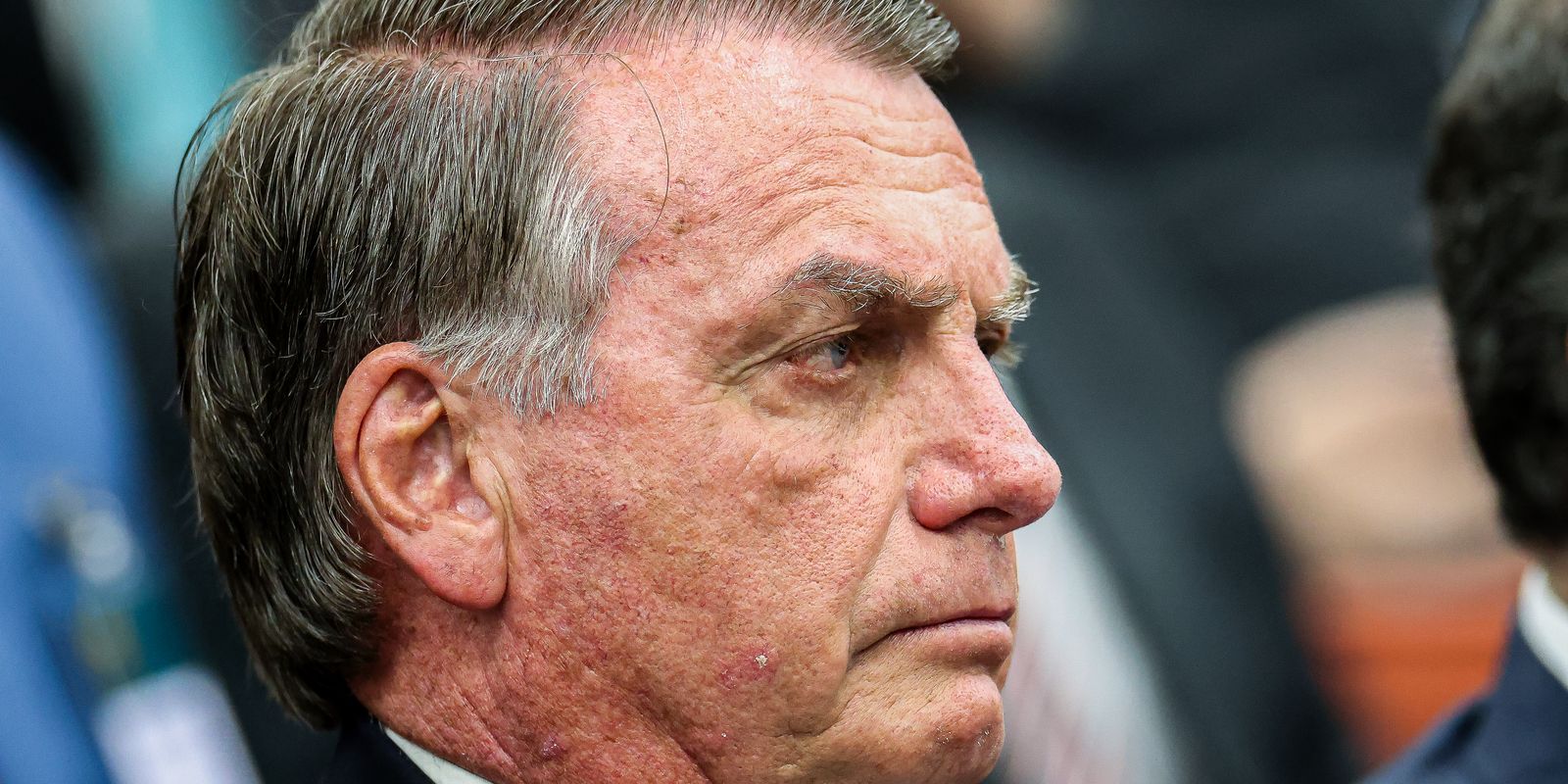 Bolsonaro pede autorização do STF para fazer procedimento médico