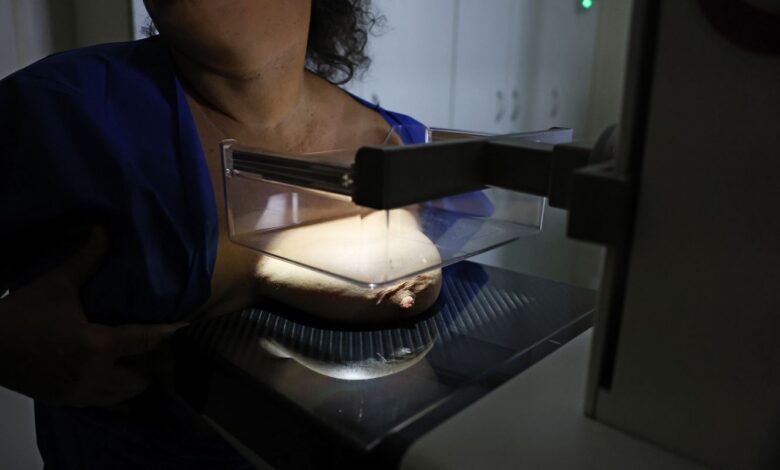 Vigitel: 92% das brasileiras entre 50 e 69 anos fizeram mamografia