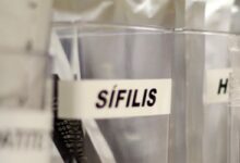 Centro de SP tem testagem grátis de HIV, hepatite, síflis e gonorreia