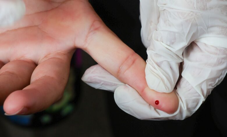 SUS passa a oferecer teste rápido de dengue