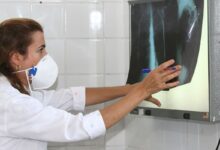 OMS recomenda testes de diagnóstico rápido para erradicar tuberculose