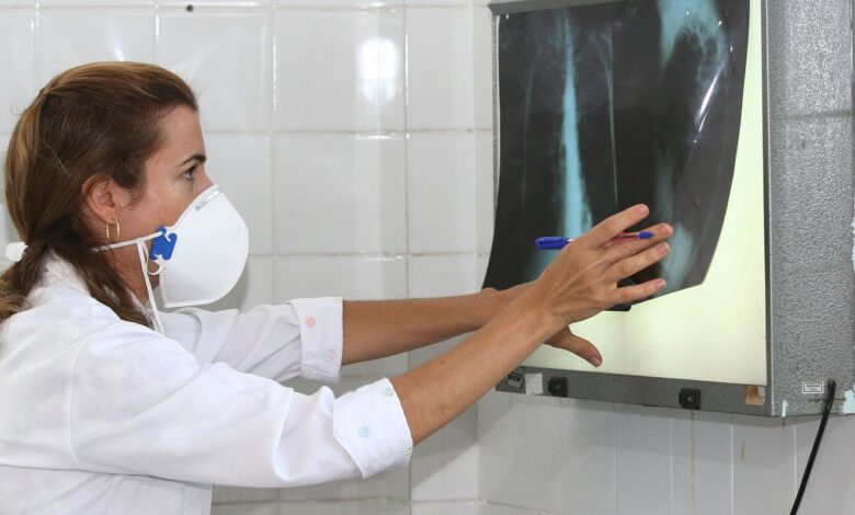 OMS recomenda testes de diagnóstico rápido para erradicar tuberculose