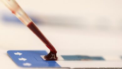 Estudo inédito da Fiocruz pode ampliar prevenção de HIV entre jovens