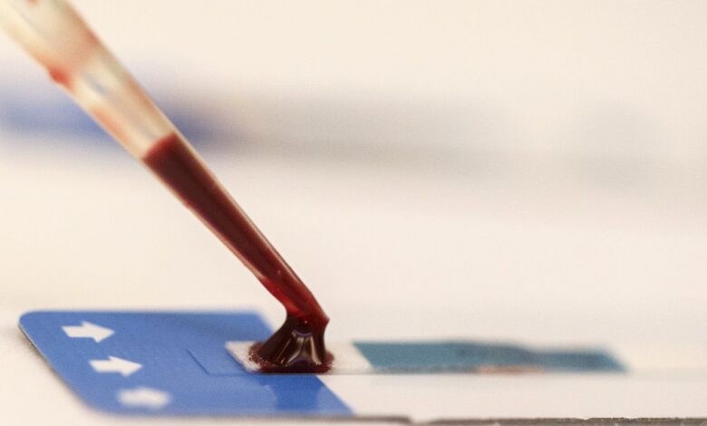 Estudo inédito da Fiocruz pode ampliar prevenção de HIV entre jovens