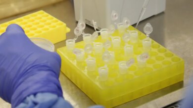 SP confirma segundo caso importado de sarampo