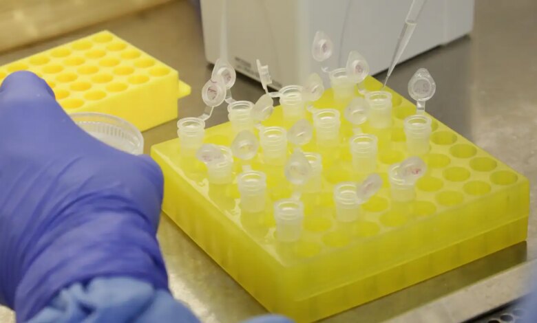 SP confirma segundo caso importado de sarampo