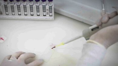 Paciente em SP com suspeita de ebola testa positivo para meningite