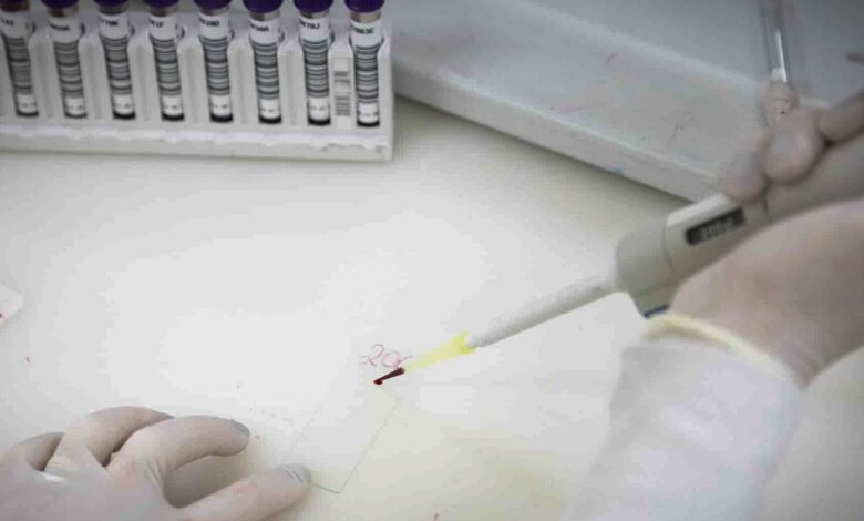 Paciente em SP com suspeita de ebola testa positivo para meningite