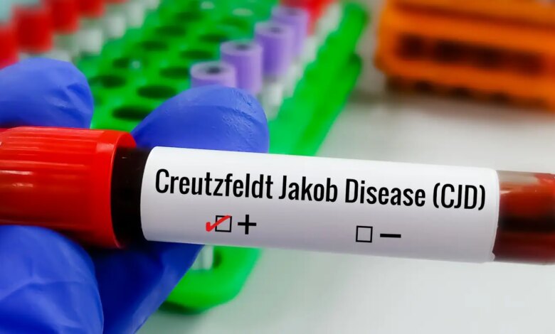 Entenda Doença de Creutzfeldt-Jakob e busca por tratamento