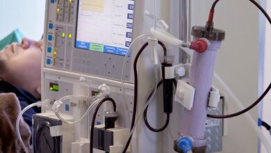 Estudo alerta para subdiagnóstico da doença renal crônica no Brasil