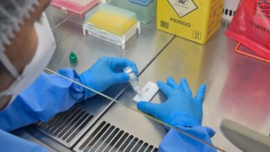 Anvisa atualiza regras sobre controle de qualidade em laboratórios