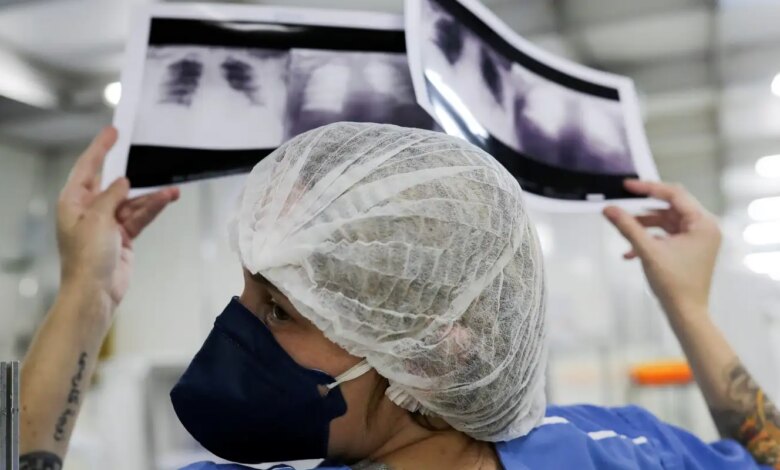 Diagnóstico tardio dá poucas chances de cura do câncer de pulmão