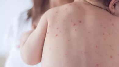 Estado de São Paulo reforça necessidade de vacinação contra o sarampo
