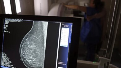 Plano de saúde terá que cobrir mamografia digital para todas as idades